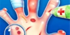 Hand Doctor â Surgery Game For Kids